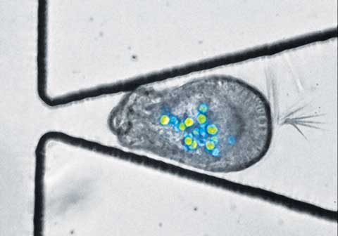 A microscopic image of a placental cell squished in between two black wires, unable to move through the small hole at which they converge. It is speckled with fluorescent material.